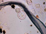 Diatom, Cyclotella